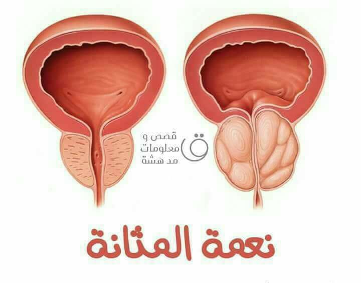 نعمة-المثانة-نعمة-واحدة-من-نعم-الله-علينا